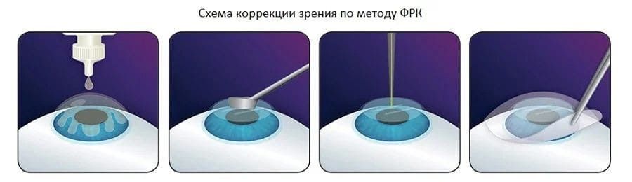 схема метода фрк